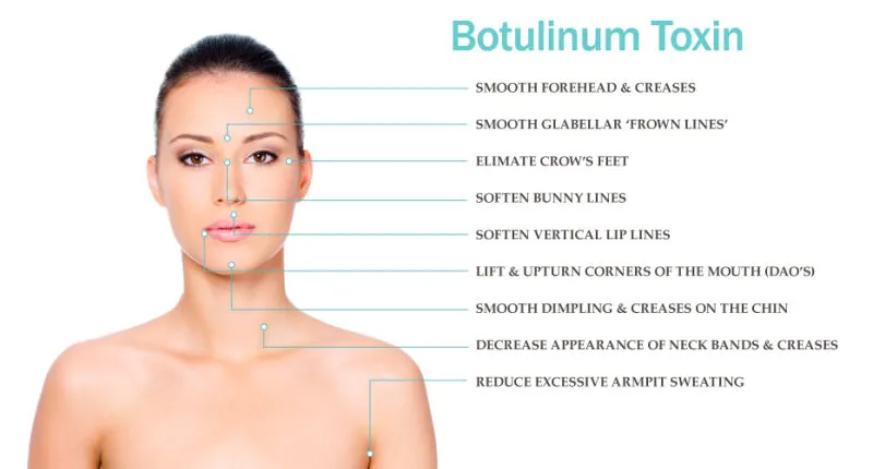 Sfiducianti Antirughe Beutox Batulaxs Resty Dermal Filler Juvederms 0